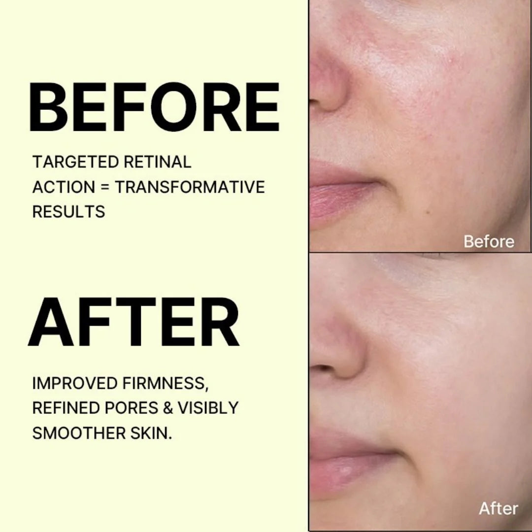 Celimax The Vita A Retinal Shot Tightening Booster 15ml