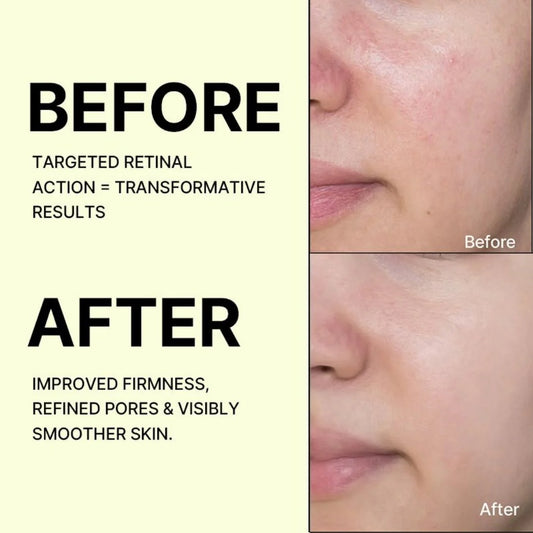 Celimax The Vita A Retinal Shot Tightening Booster 15ml